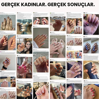 JEL TIRNAK SARGISI BAŞLANGIÇ PAKETİ